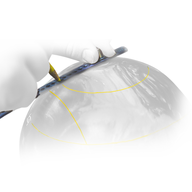 Storm Arc Ruler + Free Shipping