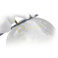 Storm Arc Ruler ALT Image